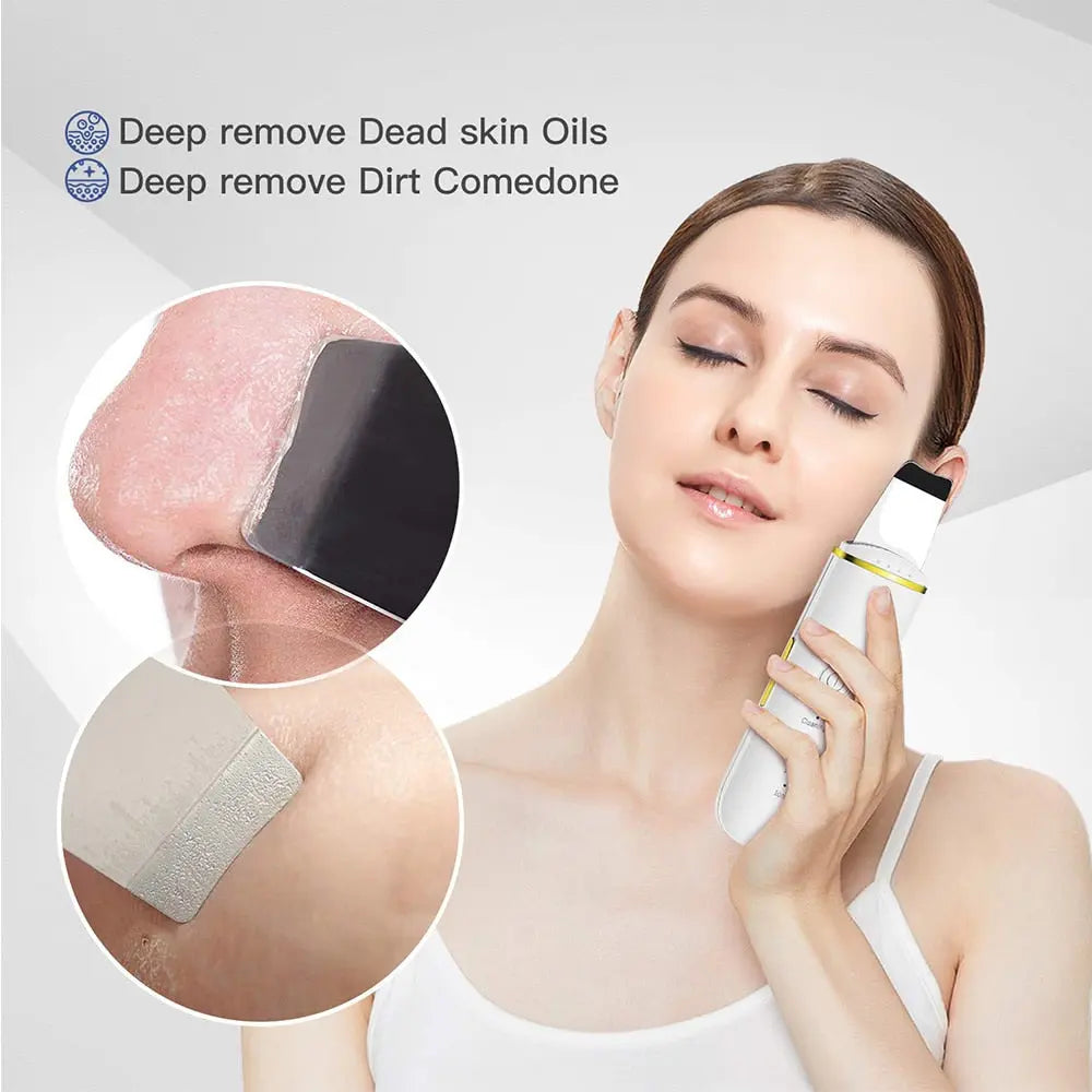 Ultrasonic Acne Blackhead Remover