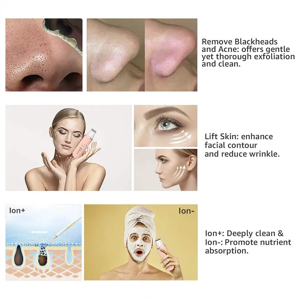 Ultrasonic Acne Blackhead Remover